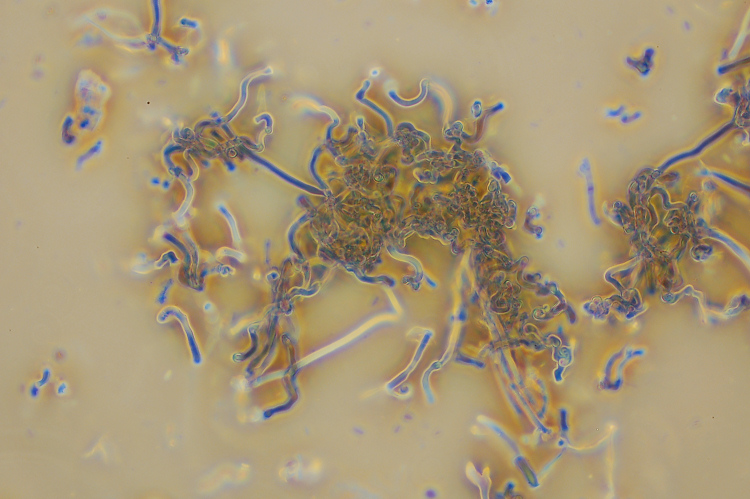 Aphyllophorales su...sabbia!! (Schizophyllum commune)